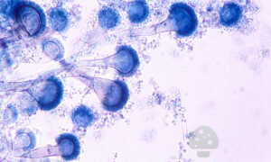 Грибковая инфекция рода аспергиллус фумигатус
