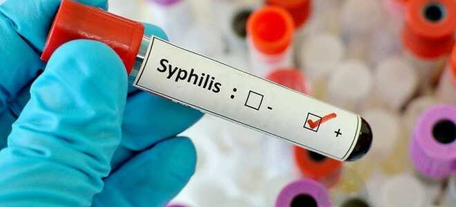 Ложноположительный анализ на сифилис