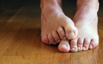 Как избавиться от грибка между пальцами ног