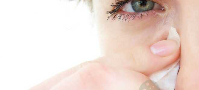Поражение области глаз периорбитальным дерматитом. Способы лечения и профилактики.
