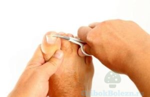 Обрезание ногтей