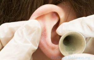 заложенность уха